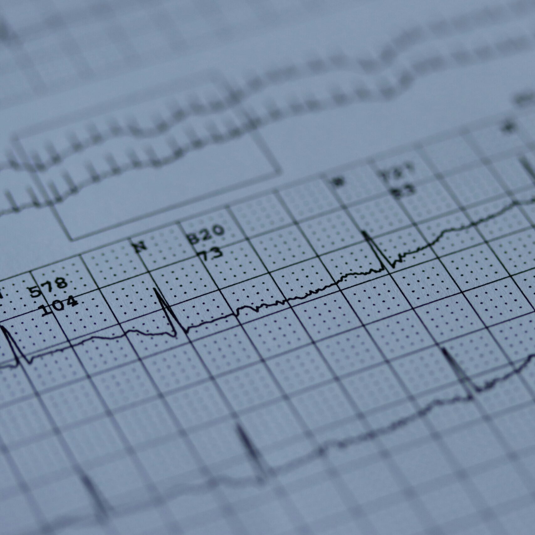 Close up of ECG